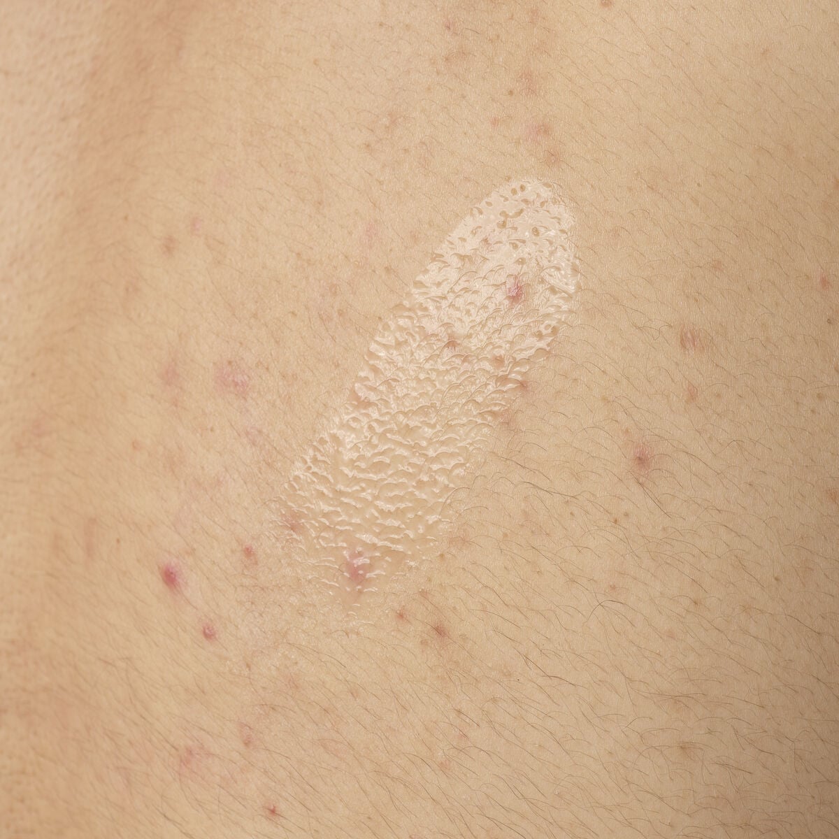 salicylic-acid-0-5-body-serum-u4 ORD-salicylic-acid-05-body-240ml-application.jpg