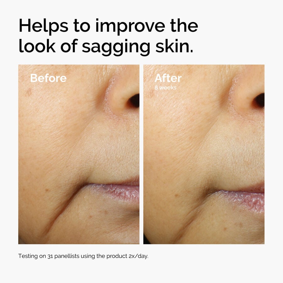 caffeine-3-escin-1-face-serum-j6 ord-caffeine-3pct-escin-1pct-face-serum-before-after-sagging.jpg