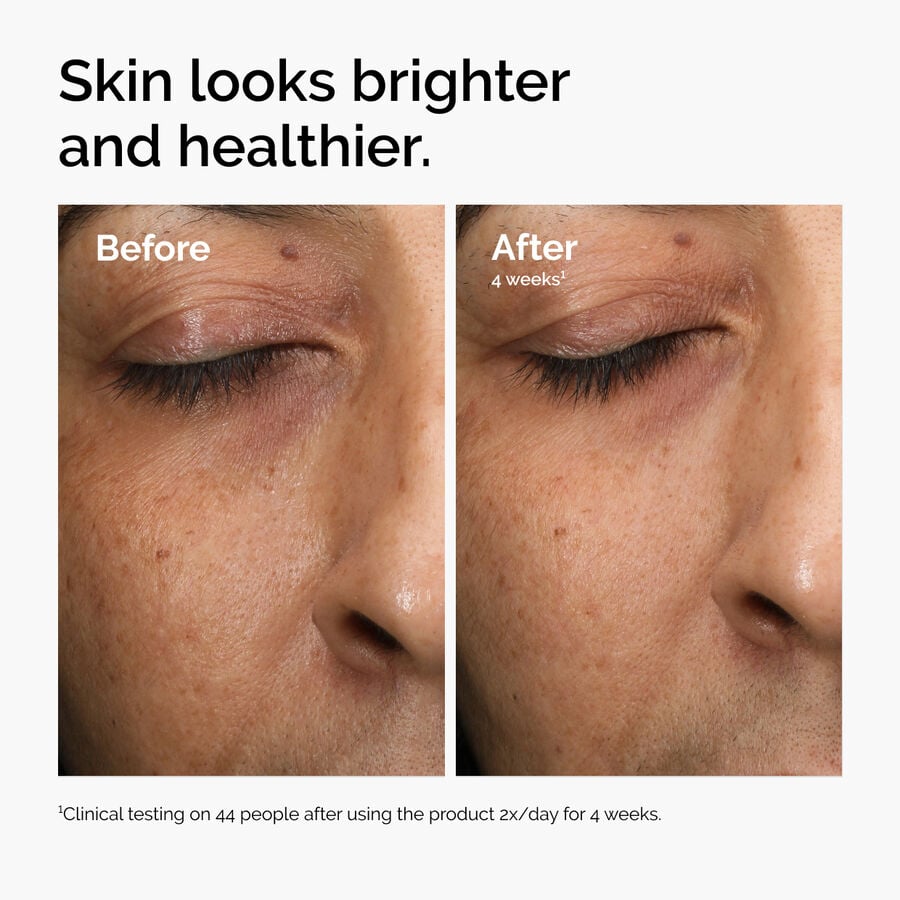 multi-antioxidant-radiance-serum-o0 ord-mars-before-after-healthy.jpg