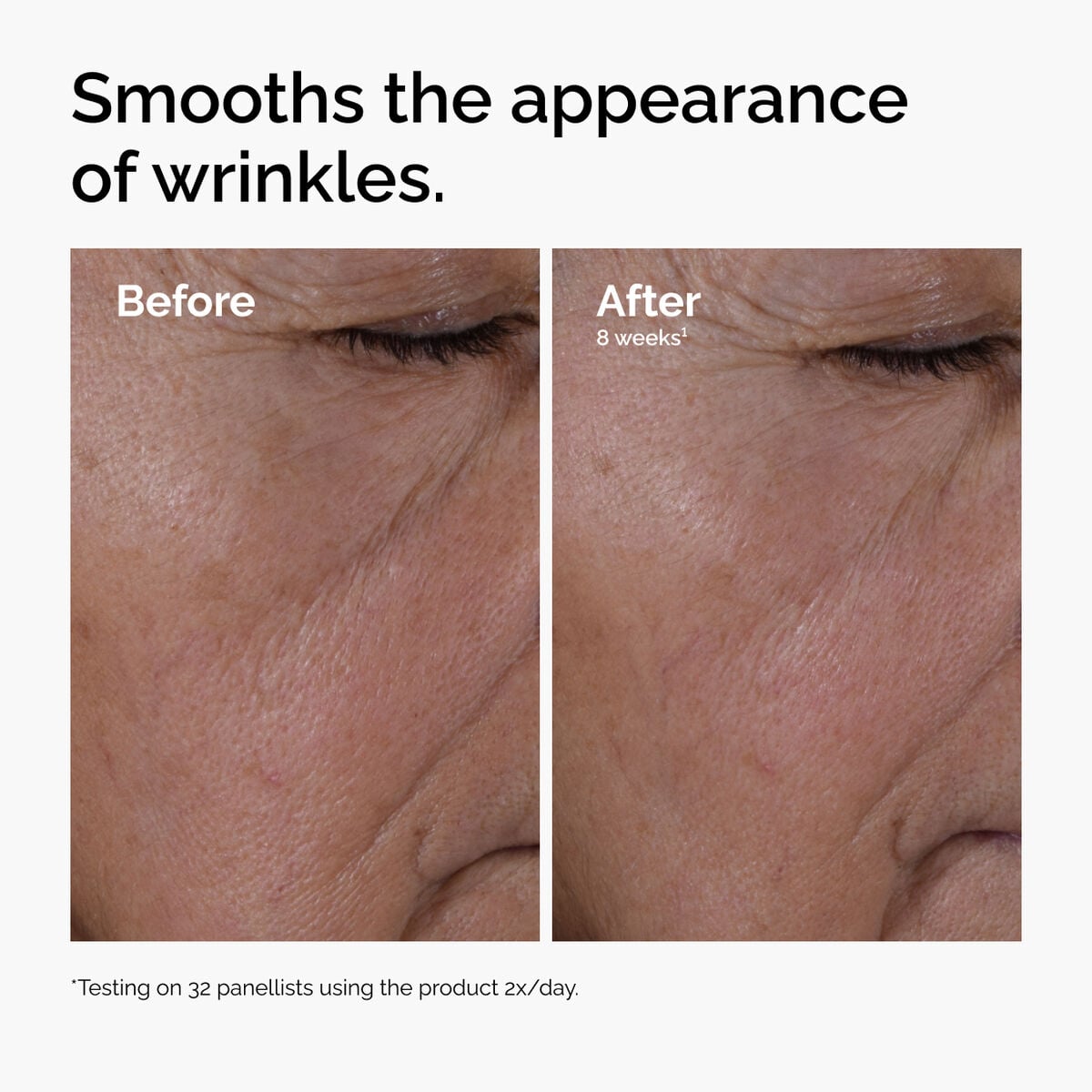 multi-peptide-ha-serum-x7 ord-multi-peptide-ha-serum-wrinkles-before-after.jpg