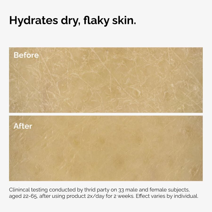 the-body-care-collection-n8 ord-natural-moisturizing-factors-inulin-body-before-after-graphic-02.jpg