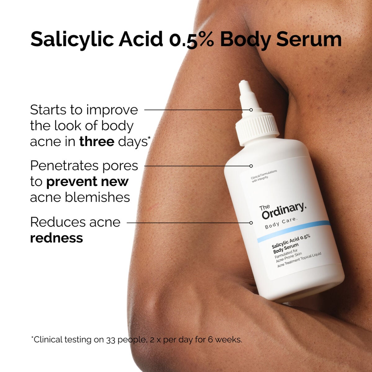 salicylic-acid-0-5-body-serum-u4 ord-salicylic-05-body-serum-otc-benefits-infographic.jpg