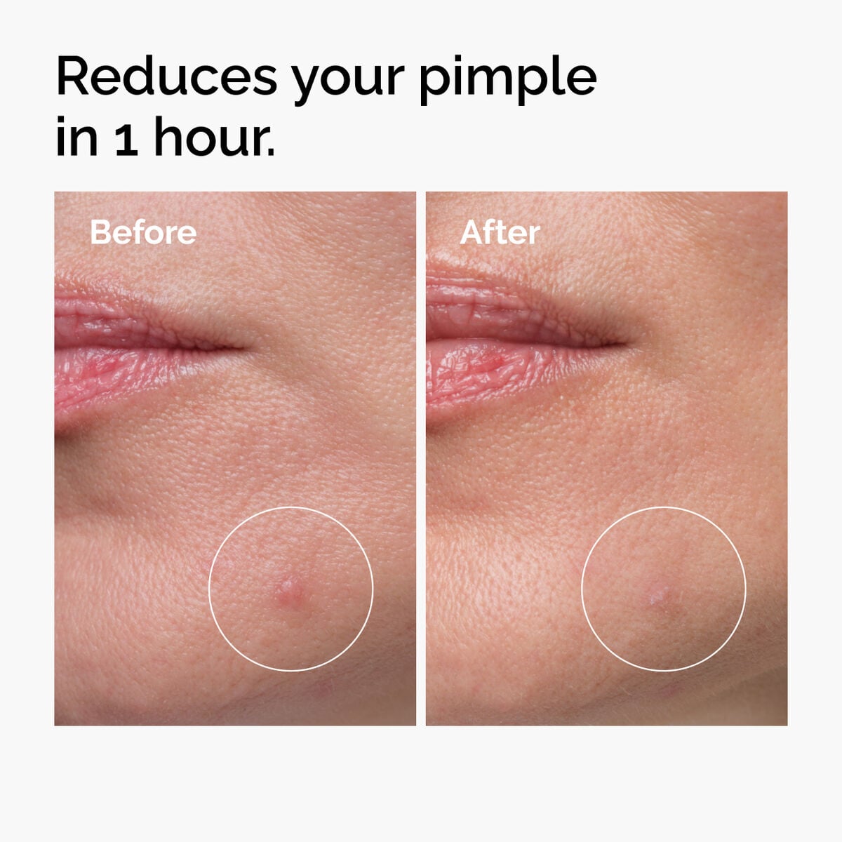 sulfur-10-powder-to-cream-concentrate-f4 ord-sulfur-10pct-powder-to-cream-concentrate-before-after-NA.jpg