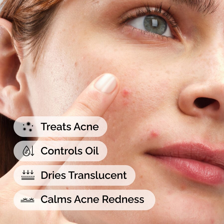 sulfur-10-powder-to-cream-concentrate-f4 ord-sulfur-10pct-powder-to-cream-concentrate-model-application-with-benefits-acne.jpg